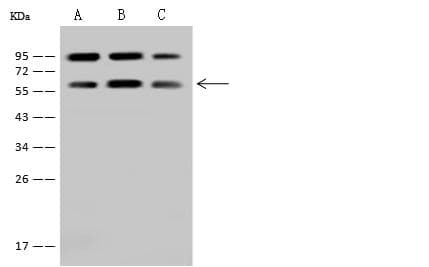 Polyclonal Rabbit anti-Human LSM14A Antibody (IHC, WB)