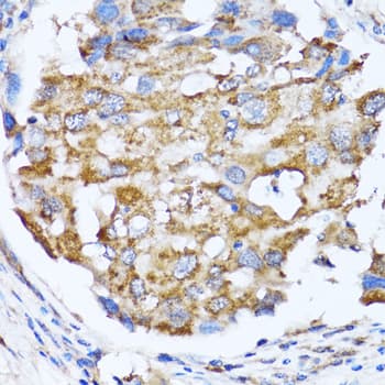 NDE1 Antibody