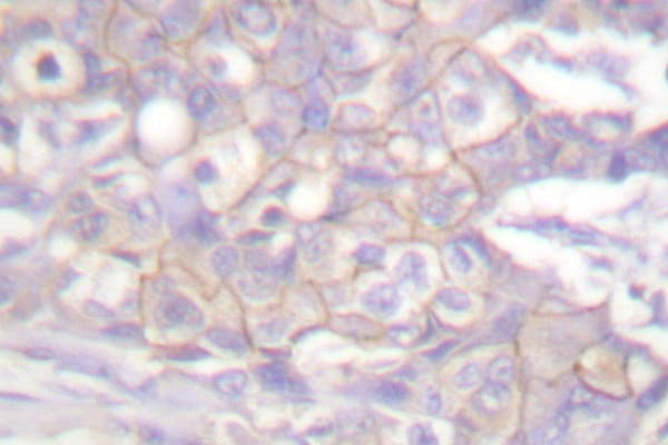 c-Src Kinase / CSK Antibody (Leu558)