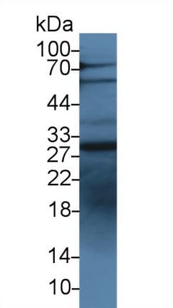 IGFBP1 Antibody (aa112-263)
