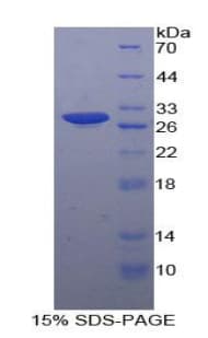 Human MAP4K5 Protein (Recombinant His-T7)