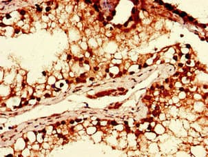 Polyclonal Rabbit anti-Human YTHDF2 Antibody