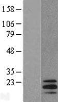 SCLIP / STMN3 Protein (Over-Expression Lysate Myc-DDK (Flag))