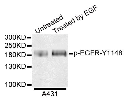 Polyclonal Rabbit anti-Human EGFR Antibody (phospho-Tyr1172, WB)