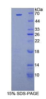 Human CCND1 / Cyclin D1 Protein (Recombinant His-GST)