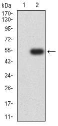 CHD4 Antibody (clone 3D3E9)