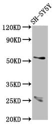 CDR2L Antibody