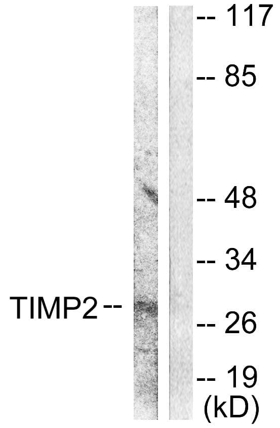 TIMP2 Antibody