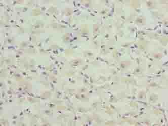 CASQ1 / Calsequestrin 1 Antibody