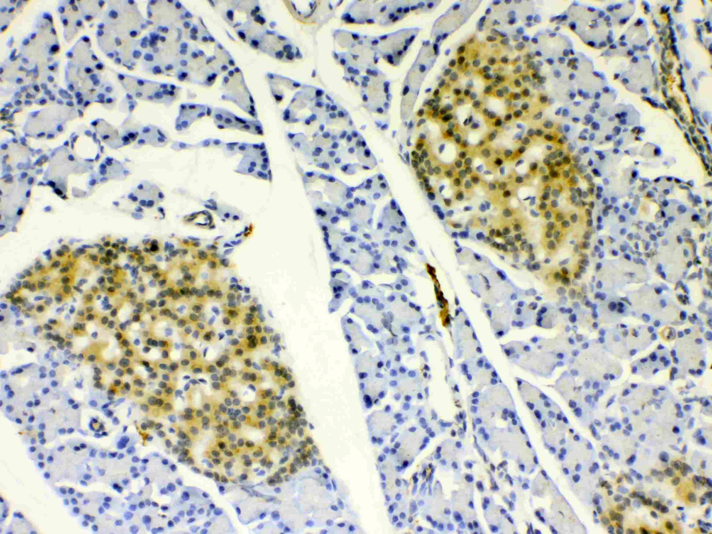 HSPB8 / H11 / HSP22 Antibody