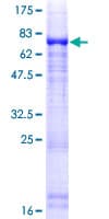Human NIM1K / NIM1 Protein (Recombinant GST)