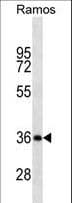 CD20 Antibody (aa266-294)
