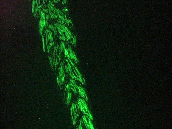ACTC1 / Alpha Cardiac Actin Antibody (clone 22D3)