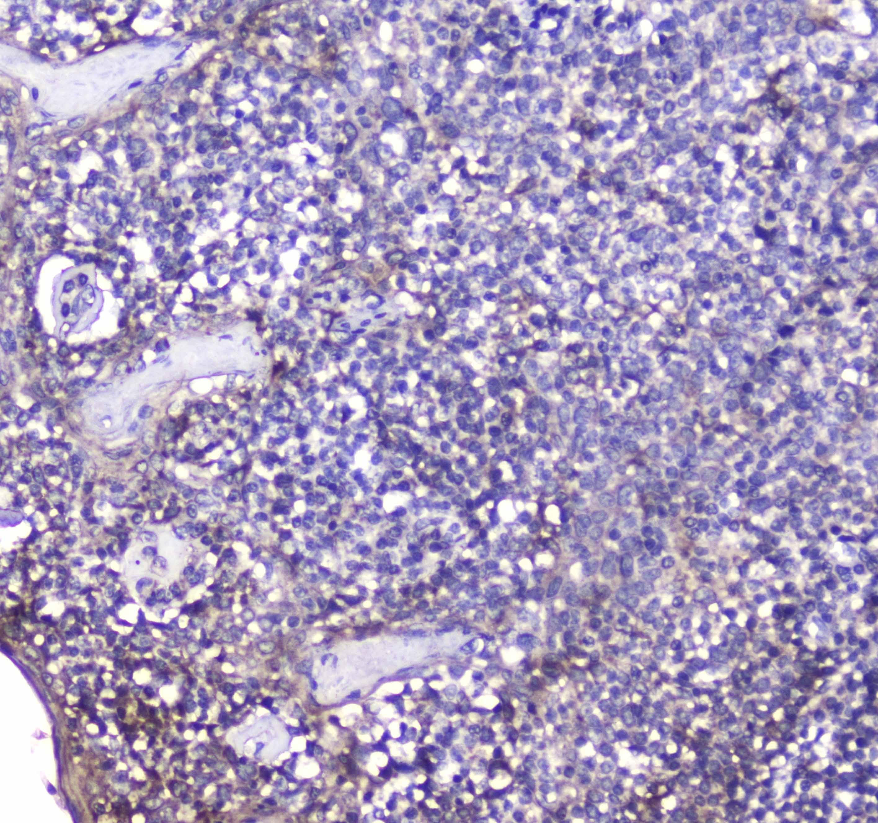 TNFRSF17 / BCMA Antibody