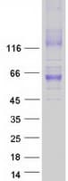 Human SLC30A1 / ZNT1 Protein (Recombinant Myc-DDK (Flag))