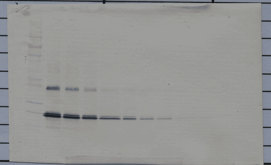 Polyclonal Rabbit anti-Human IL11 Antibody (Biotin, WB)