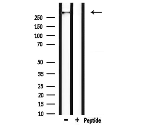 HECTD1 Antibody