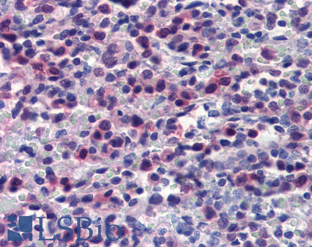IHC-plus™ CASP7 / Caspase 7 Antibody (clone 10-1-62)
