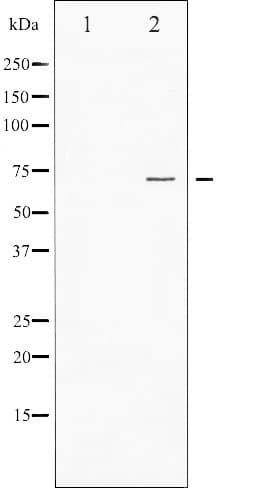 FOXO1 / FKHR Antibody