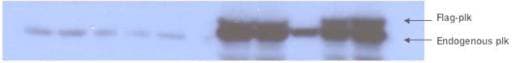 IHC-plus™ Polyclonal Rabbit anti-Human PLK1 / PLK-1 Antibody (phospho-Thr210, IHC, WB)