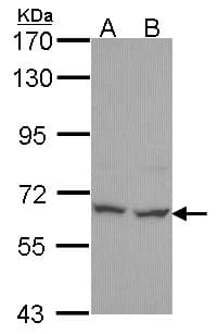 PNKP Antibody