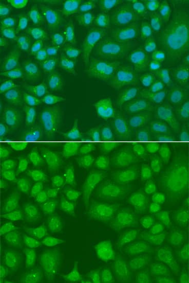 Polyclonal Rabbit anti-Human AES / Groucho Antibody (IHC, IF, WB)