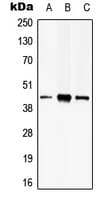 PSKH2 Antibody (Internal)