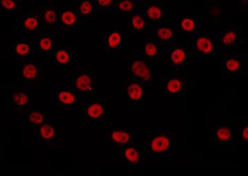 Polyclonal Rabbit anti-Human HAT1 Antibody (IF, WB)