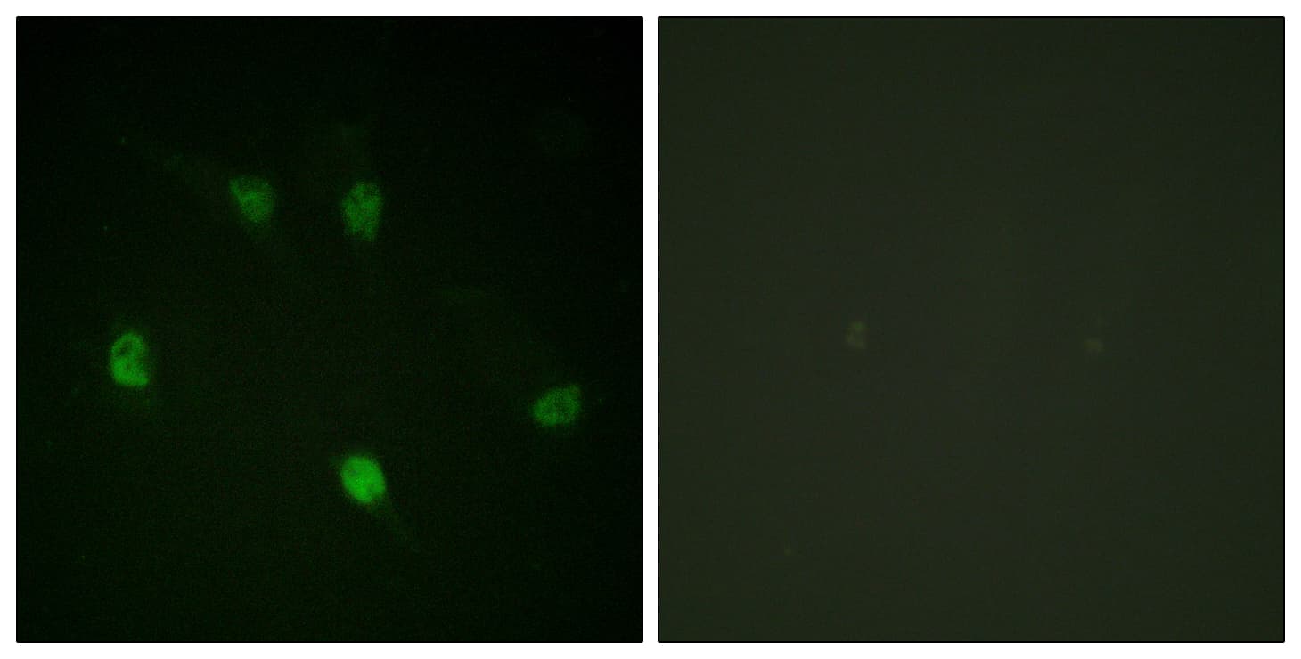 IHC-plus™ CCNE1 / Cyclin E1 Antibody (aa43-92)