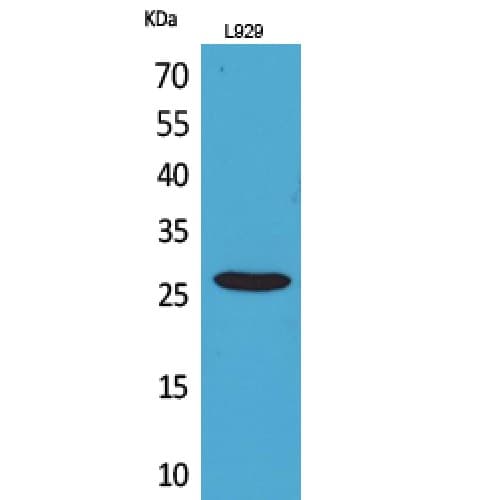 KLRC1 + KLRC2 Antibody (101-150 aa, Internal)