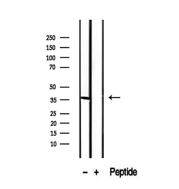 RLBP1 / CRALBP Antibody