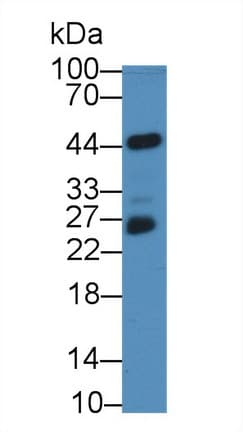 NF2 / Merlin Antibody (aa30-239)
