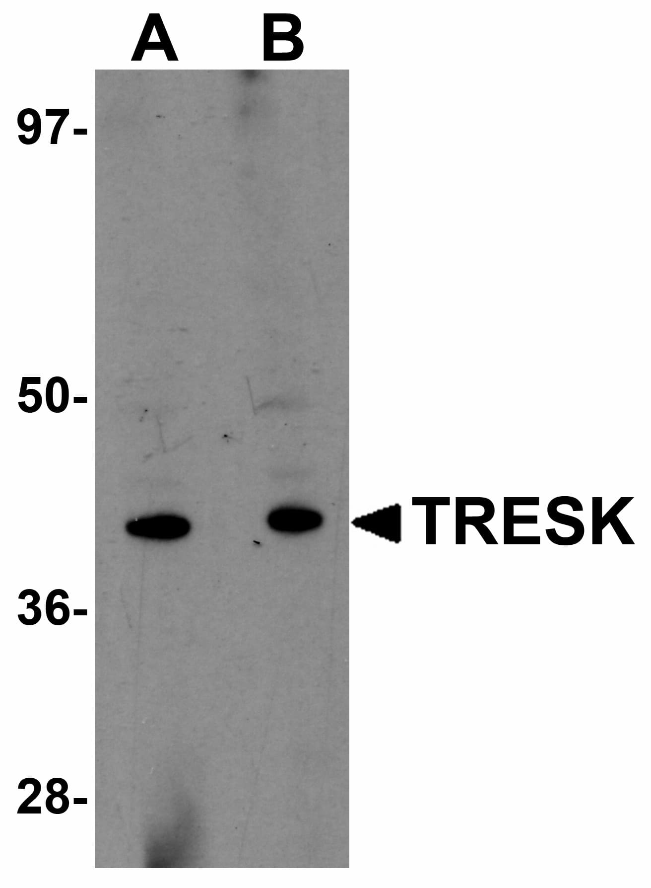 IHC-plus™ Polyclonal Rabbit anti-Human KCNK18 / TRESK Antibody (IHC, IF, WB)