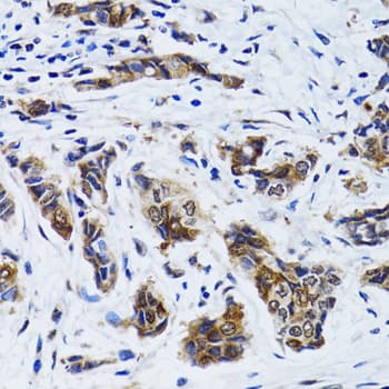 FASN / Fatty Acid Synthase Antibody