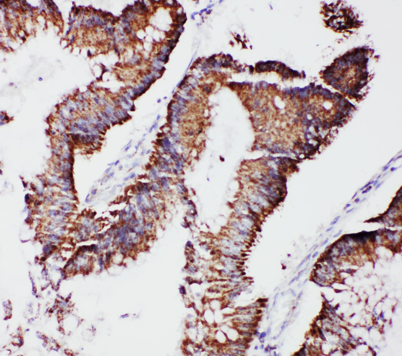 MtTFA / TFAM Antibody (aa227-246)