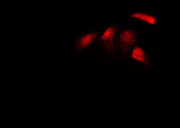 Polyclonal Rabbit anti-Human RELB Antibody (IF, WB)