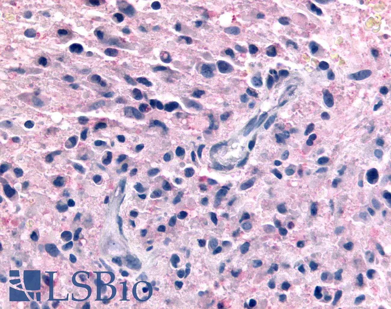PathPlus™ Polyclonal Rabbit anti-Human P2RY12 / P2Y12 Antibody (N-Terminus, IHC)