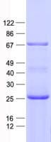 Human CEP63 Protein (Recombinant His, N-Terminal)