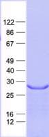 Human ANP32C Protein (Recombinant His, N-Terminal)