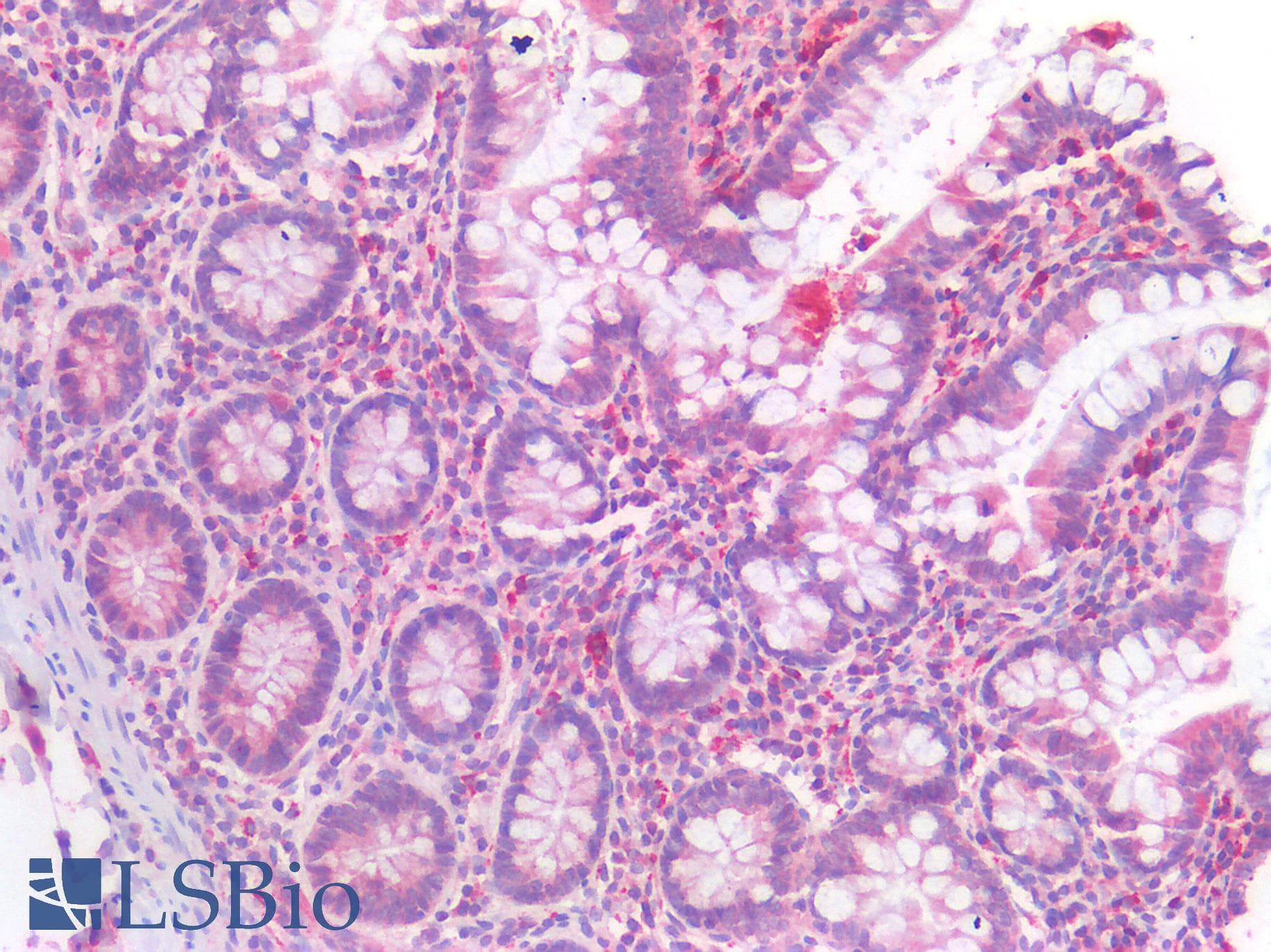 IHC-plus™ CASP3 / Caspase 3 Antibody