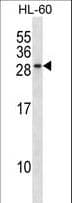 Polyclonal Rabbit anti-Human RAB15 Antibody (aa105-133, WB)