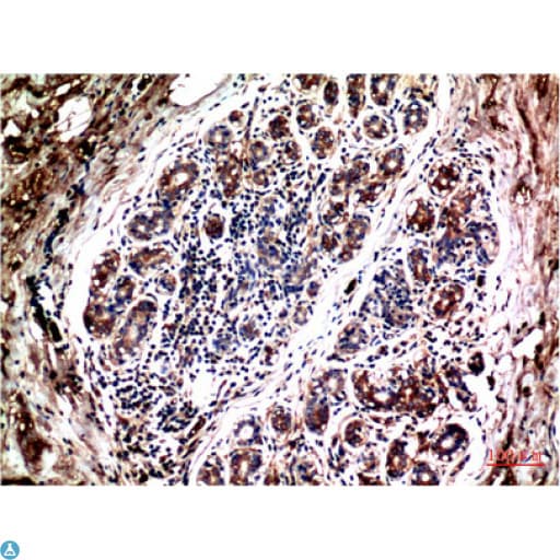 AKT1 Antibody