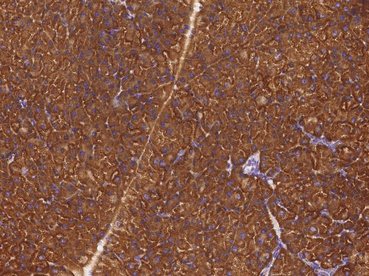 RPS6 / Ribosomal Protein S6 Antibody