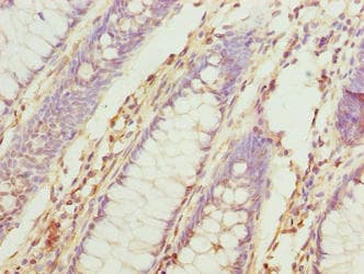 TUBB6 / Tubulin Beta 6 Antibody (aa1-446)