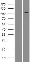 STK9 / CDKL5 Protein (Over-Expression Lysate Myc-DDK (Flag))