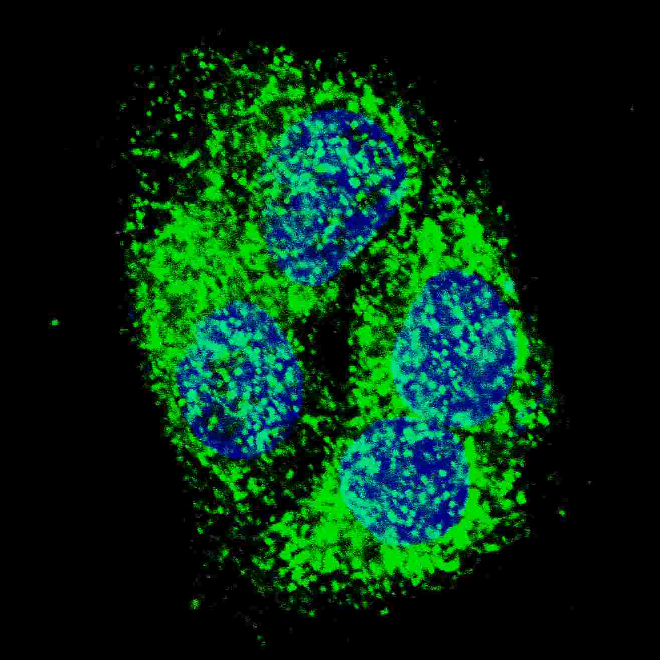 Polyclonal Rabbit anti-Human NIP3 / BNIP3 Antibody (aa152-187, IHC, IF, WB)