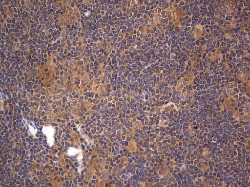 Monoclonal Mouse anti-Human ARAF / ARAF1 / A-RAF Antibody (clone OTI2G9, aa145-365, IHC, WB)