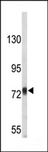APP / Beta Amyloid Precursor Antibody (aa735-763)