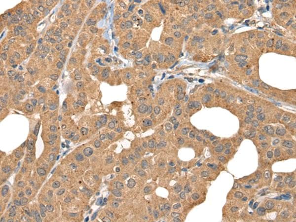 Polyclonal Rabbit anti-Human BOLA1 Antibody (IHC)