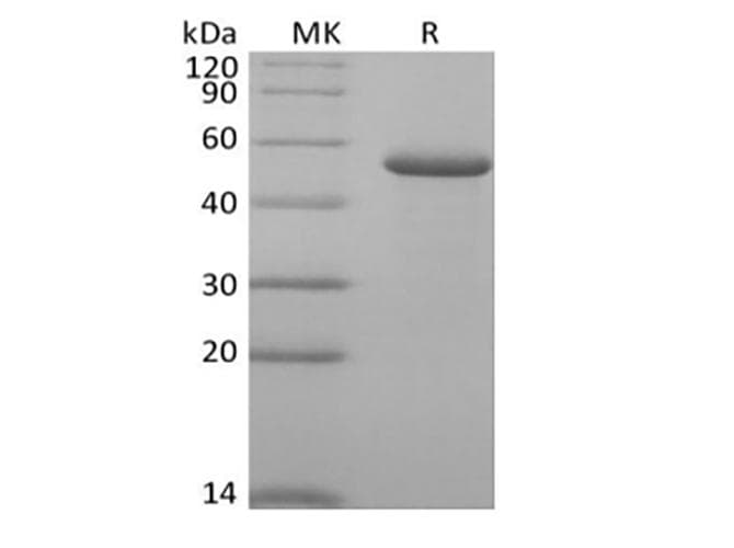 Human RCN2 Protein (Recombinant 6His, C-terminus)